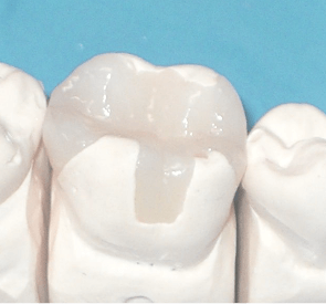 Астана лечение зубов под наркозом thumbnail